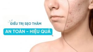 Có nhiều phương pháp điều trị sẹo thâm