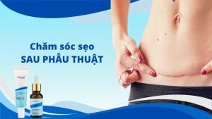 Top kem điều trị sẹo sau phẫu thuật tốt nhất