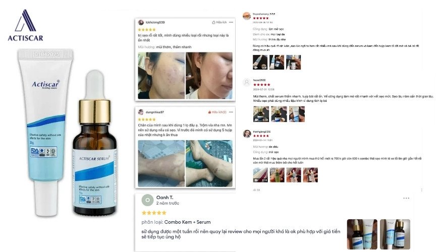 Actiscar xoá mờ sẹo nhận được nhiều đánh giá tích cực từ người dùng