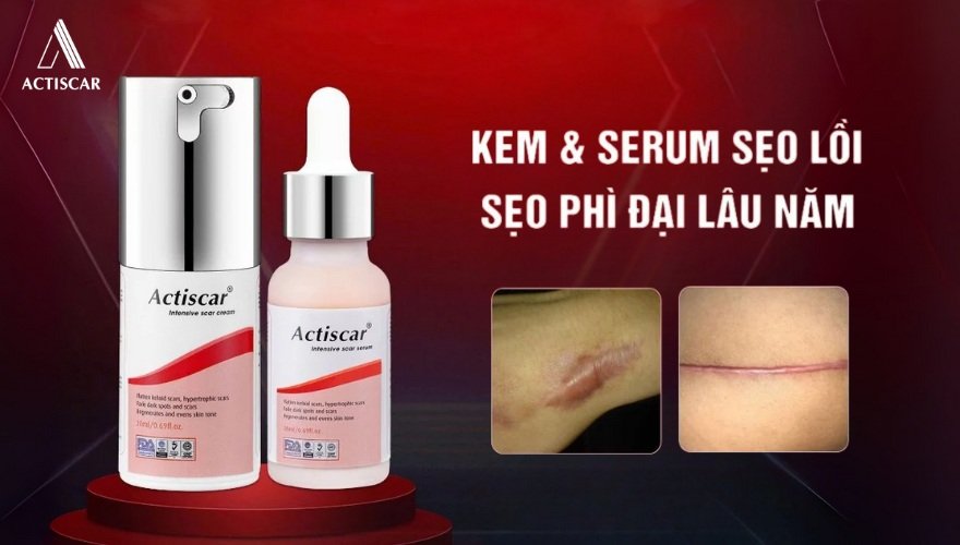 Bộ đôi Actiscar giải pháp toàn diện cho sẹo lồi