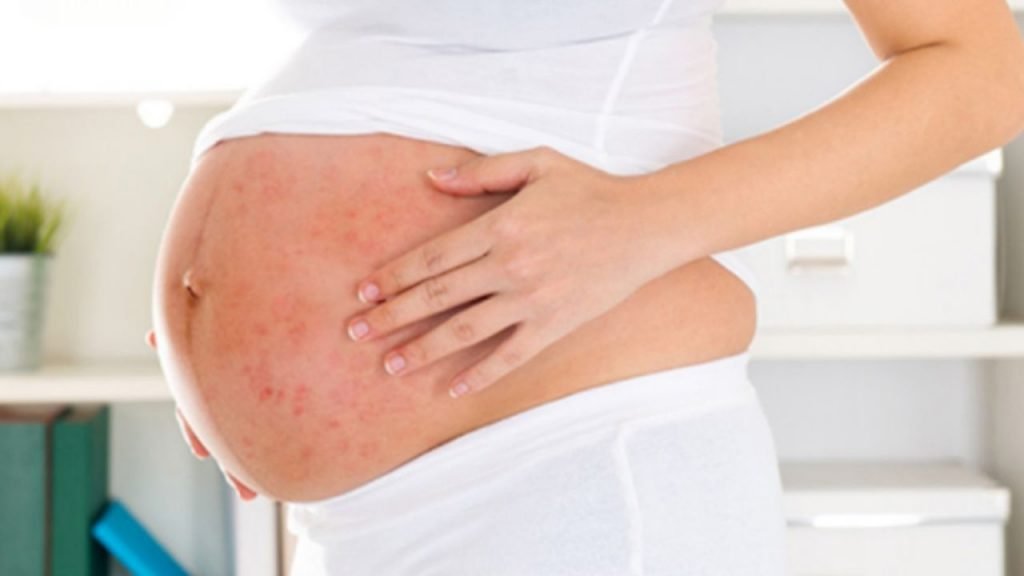Các vấn đề cần lưu ý khi sử dụng kem trị sẹo cho bà bầu