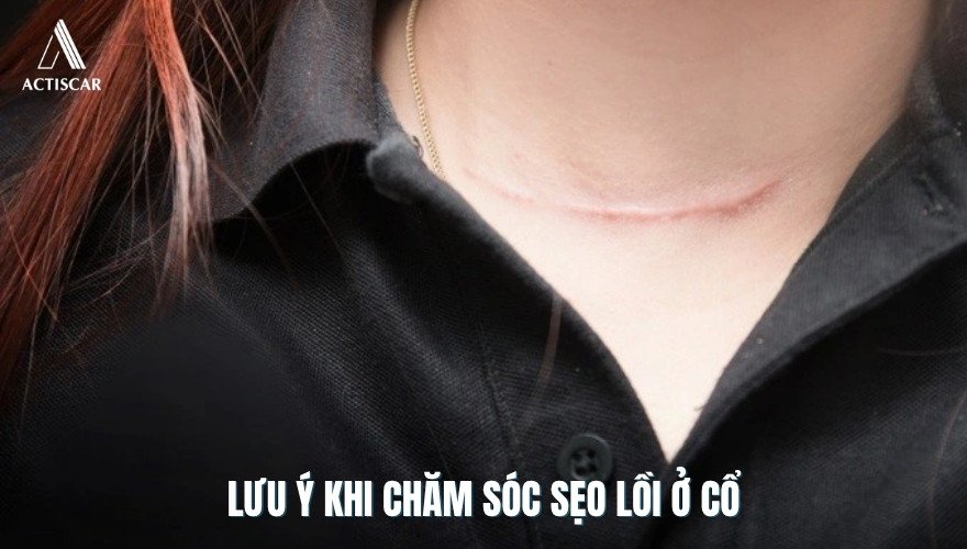 Cách chăm sóc vùng sẹo ở cổ để tăng hiệu quả mờ sẹo