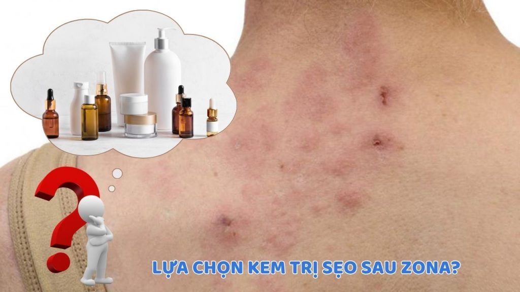 Cần cân nhắc nhiều tiêu chí khi lựa chọn kem trị sẹo sau Zona