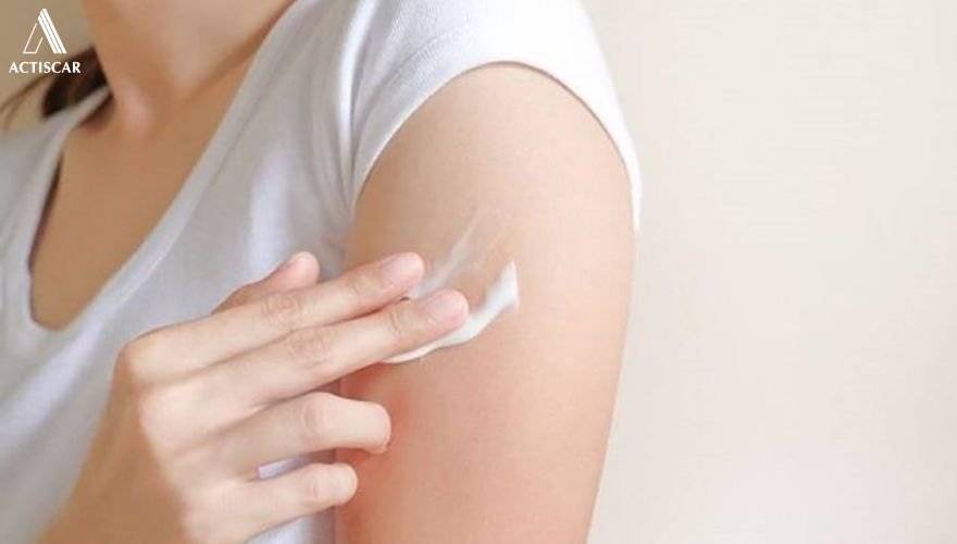 Chọn kem trị sẹo hiệu quả, đã trải qua quá trình kiểm nghiệm