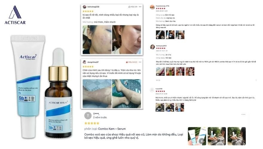 Đánh giá từ khách hàng sử dụng kem mờ sẹo Actiscar