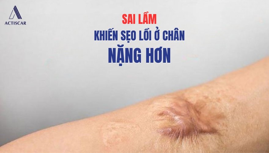 Điểm danh những sai lầm khiến sẹo lồi ở chân nặng hơn