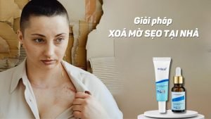 Kem trị sẹo cho bà bầu - Giải pháp xoá mờ sẹo tại nhà
