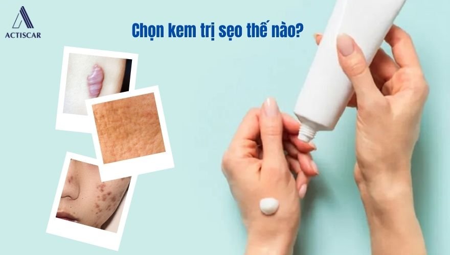 Lựa chọn kem trị sẹo hiệu quả cho từng loại sẹo