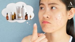 Lựa chọn kem trị sẹo lâu năm phù hợp để tối ưu hiệu quả