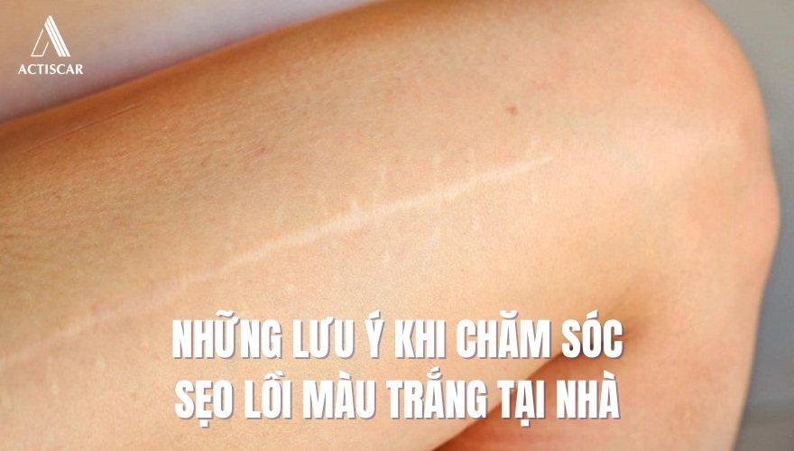 Lưu ý khi chăm sóc sẹo lồi màu trắng tại nhà