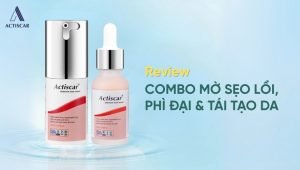 Review kem trị sẹo lồi lâu năm Actiscar