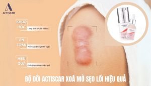 Sử dụng cả bộ kem và Serum Actiscar giúp tăng hiệu quả làm mờ sẹo lồi