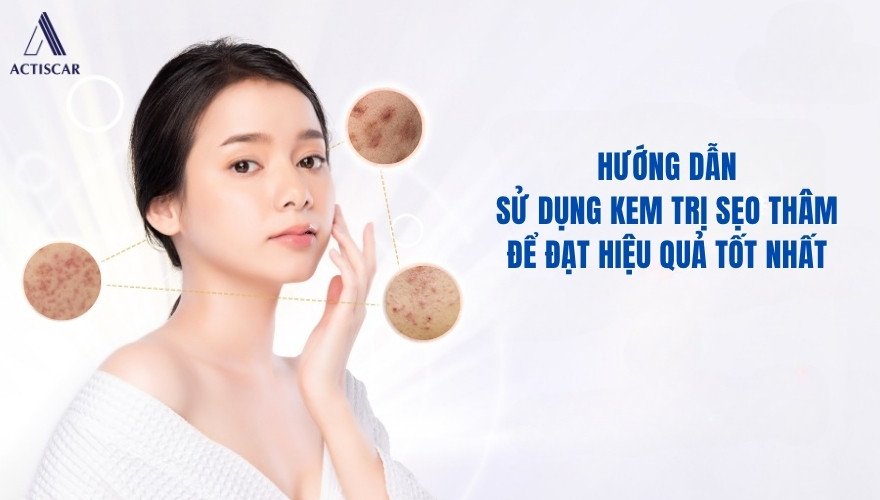 Sử dụng kem trị sẹo thâm đúng cách để tăng hiệu quả điều trị