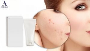 Tiêu chí lựa chọn kem trị sẹo hiệu quả phù hợp