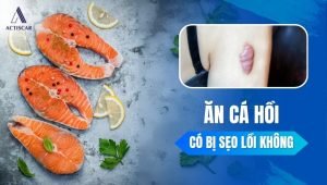 Ăn cá hồi có bị sẹo lồi không