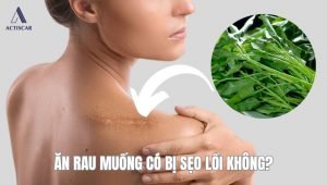 Ăn rau muống có bị sẹo lồi không?