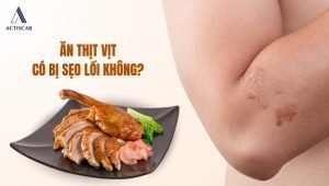 Ăn thịt vịt có bị sẹo lồi không?