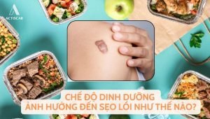 Ảnh hưởng của chế độ dinh dưỡng đến sẹo lồi