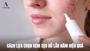 Cách lựa chọn kem trị sẹo rỗ lâu năm hiệu quả nhất