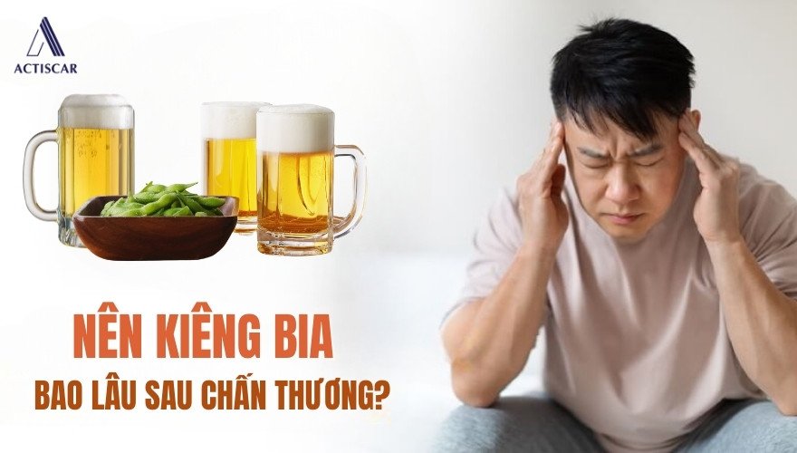Cần kiêng bia bao lâu sau chấn thương
