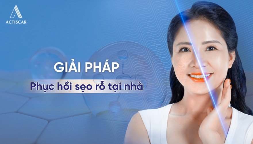 Giải pháp cải thiện sẹo rỗ đáy nhọn tại nhà