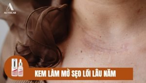 Giới thiệu kem trị sẹo lồi lâu năm