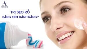 Lời đồn trị sẹo rỗ bằng kem đánh răng bắt nguồn từ đâu?