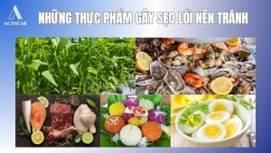 Những thực phẩm gây sẹo lồi nên tránh