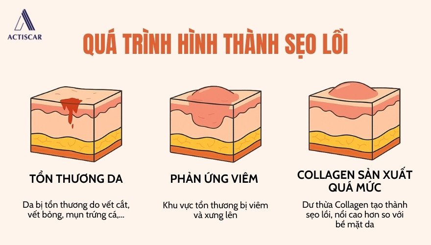 Quá trình hình thành của sẹo lồi trên da