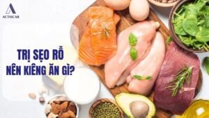 Trị sẹo rỗ kiêng ăn gì?