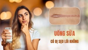 Uống sữa có bị sẹo lồi không?